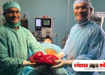 ३५ सेंमी लांबीचा, २.६ किलो वजनाचा ट्युमर काढण्यात डॉक्टरांचे यश 